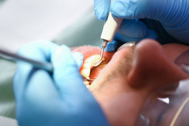 Best Broken or Chipped Tooth Repair in Hastings, MN